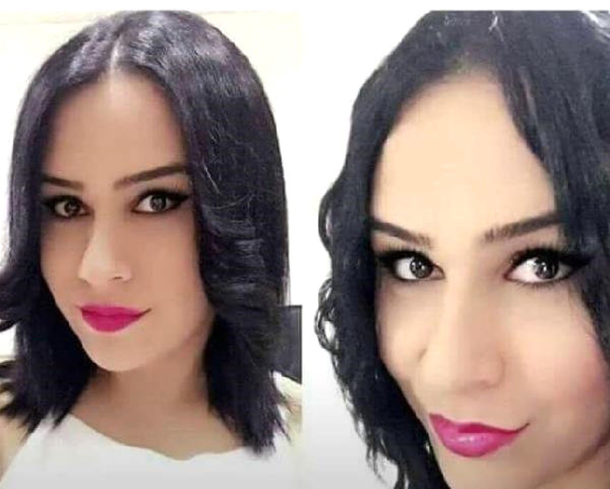 Cinsiyet Değişimi Ameliyatı Sonrasında Hayatını Kaybetti