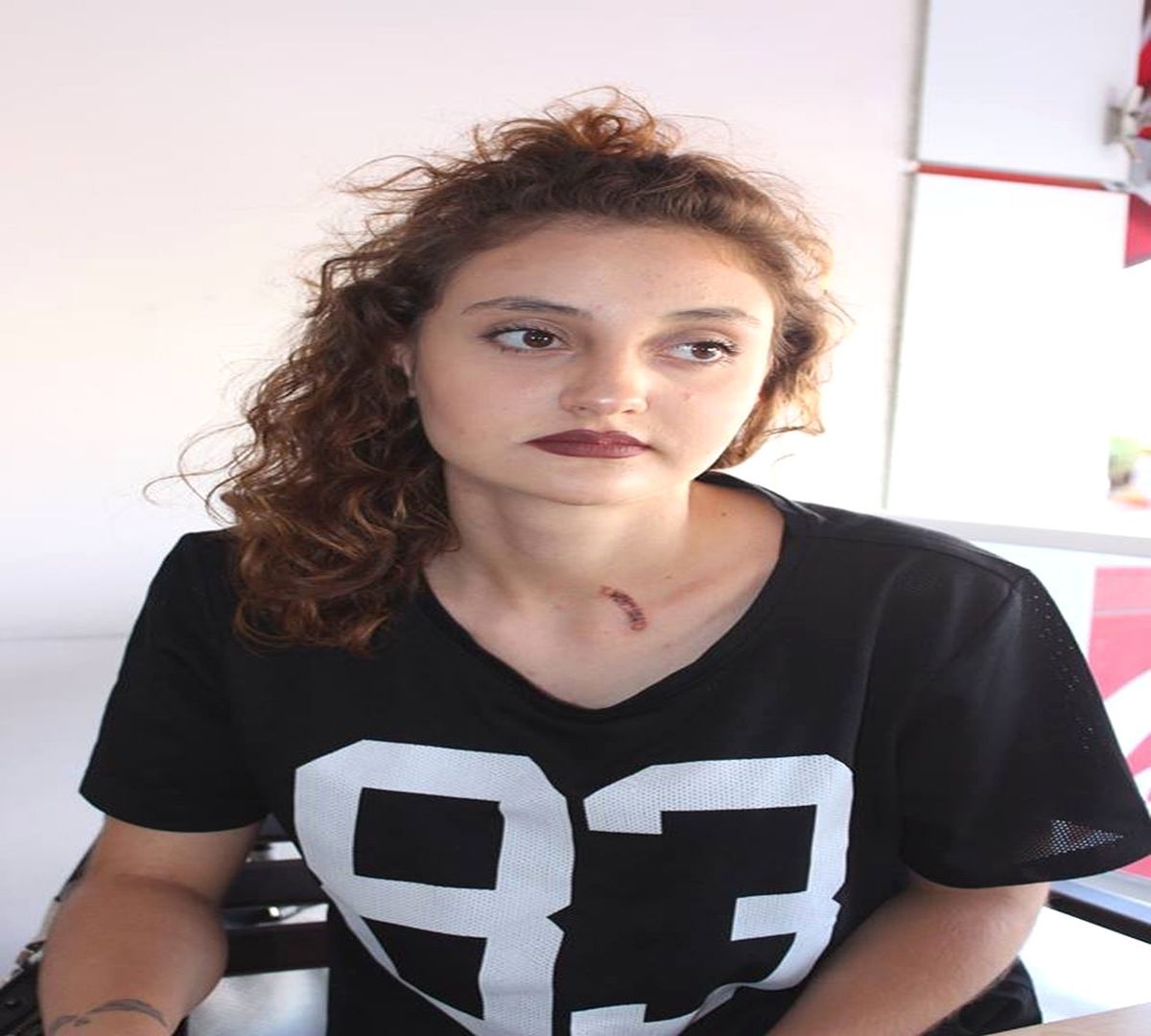 Genç Kıza Sigaralı Saldırı