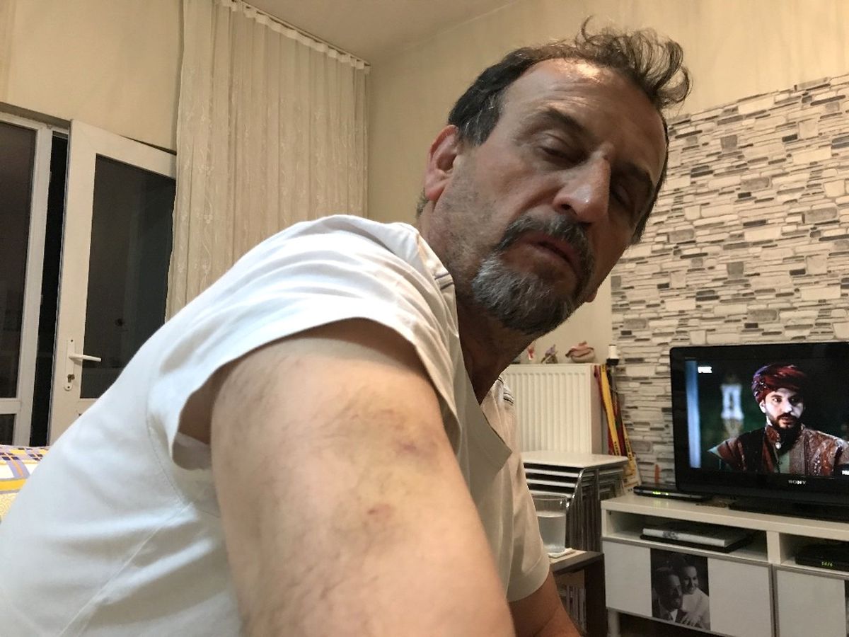 Engelli Yoluna Park Etme" Dediği İçin Linç Edildi..