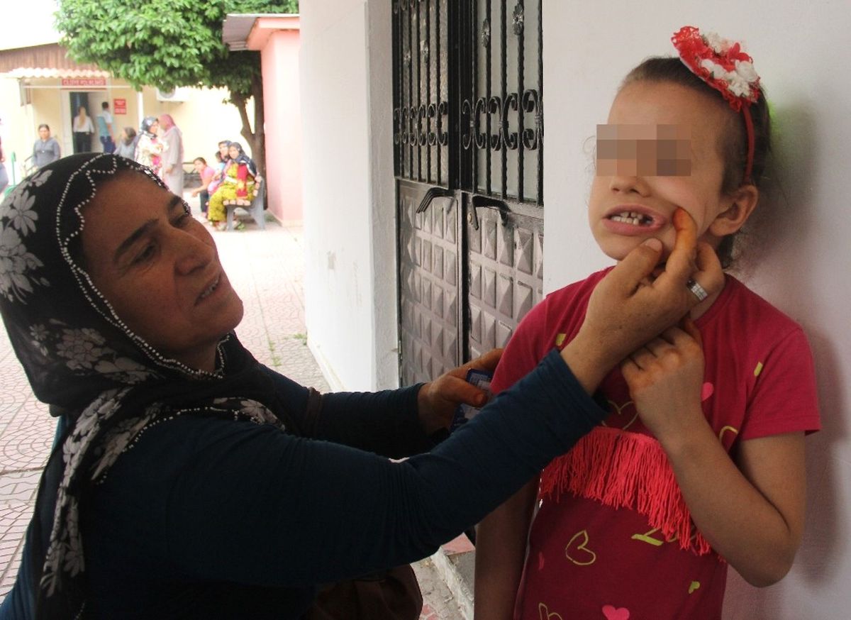 Kadın Öğretmenin Öğrencinin Dişini Kırdığı İddiası
