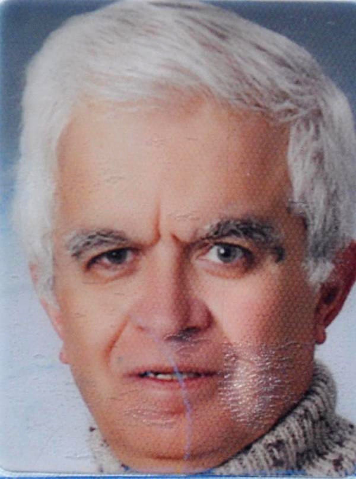 Merdivenlerden Yuvarlanıp Hayatını Kaybetti