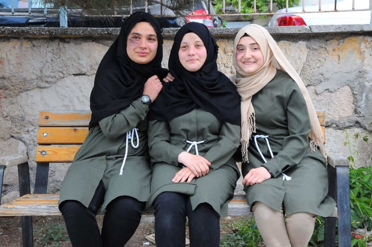 Kaza Geçiren Arkadaşları İçin Göz Altlarını Boyadılar