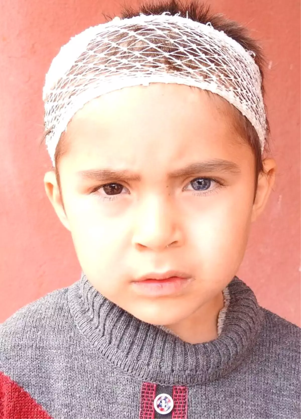 Küçük Hüseyin\'in Bir Gözü Mavi Diğeri Kahverengi