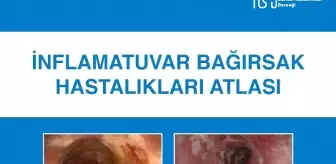 İnflamatuar Bağırsak Hastalıkları Atlası' Kitabı Yayımlandı