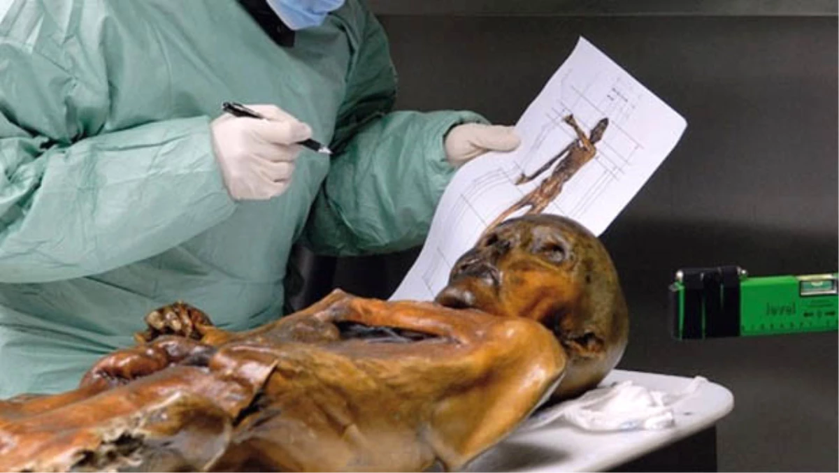 Buz Adam Ötzi\'yi Kim Öldürdü?