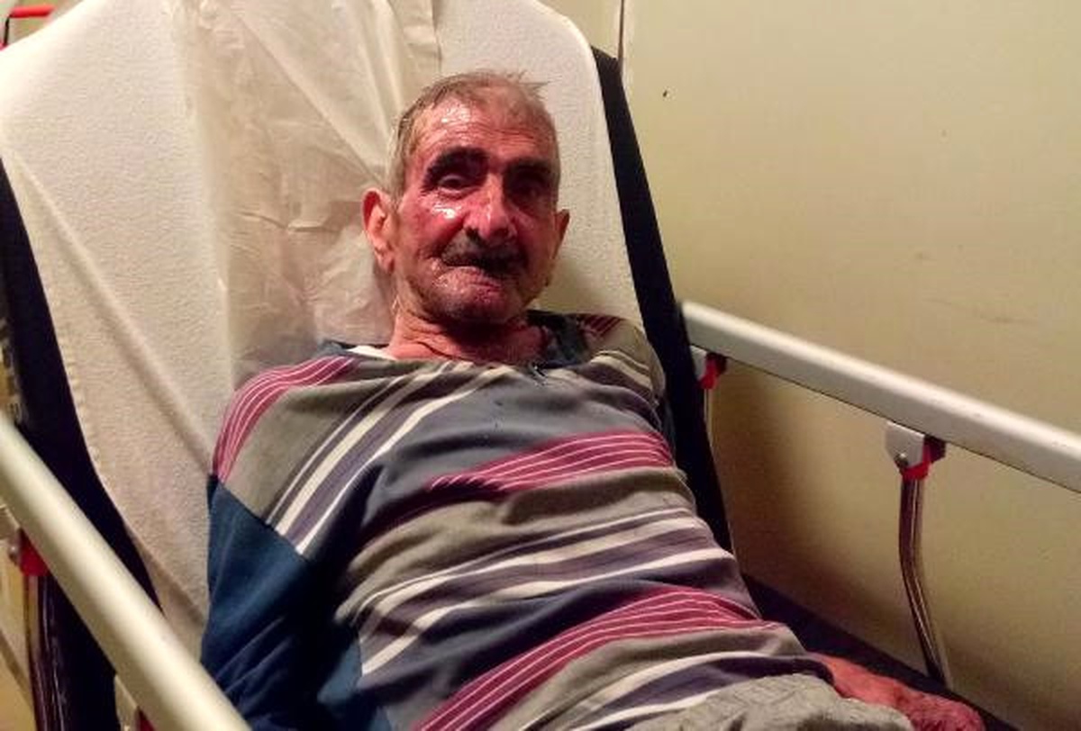 Oksijen Maskesi ile Sigara İçti Bu Hale Geldi