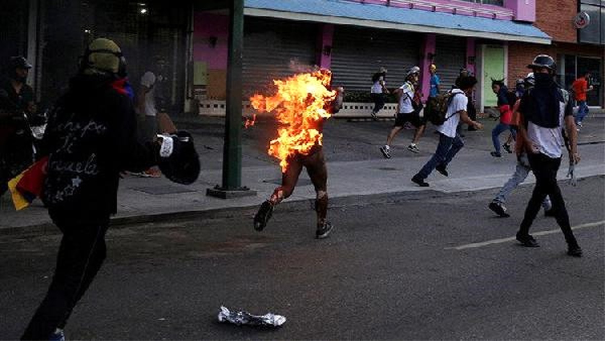 Venezuela\'da Protestocuların Önce Linç Edip Sonra Yaktıkları Genç Öldü