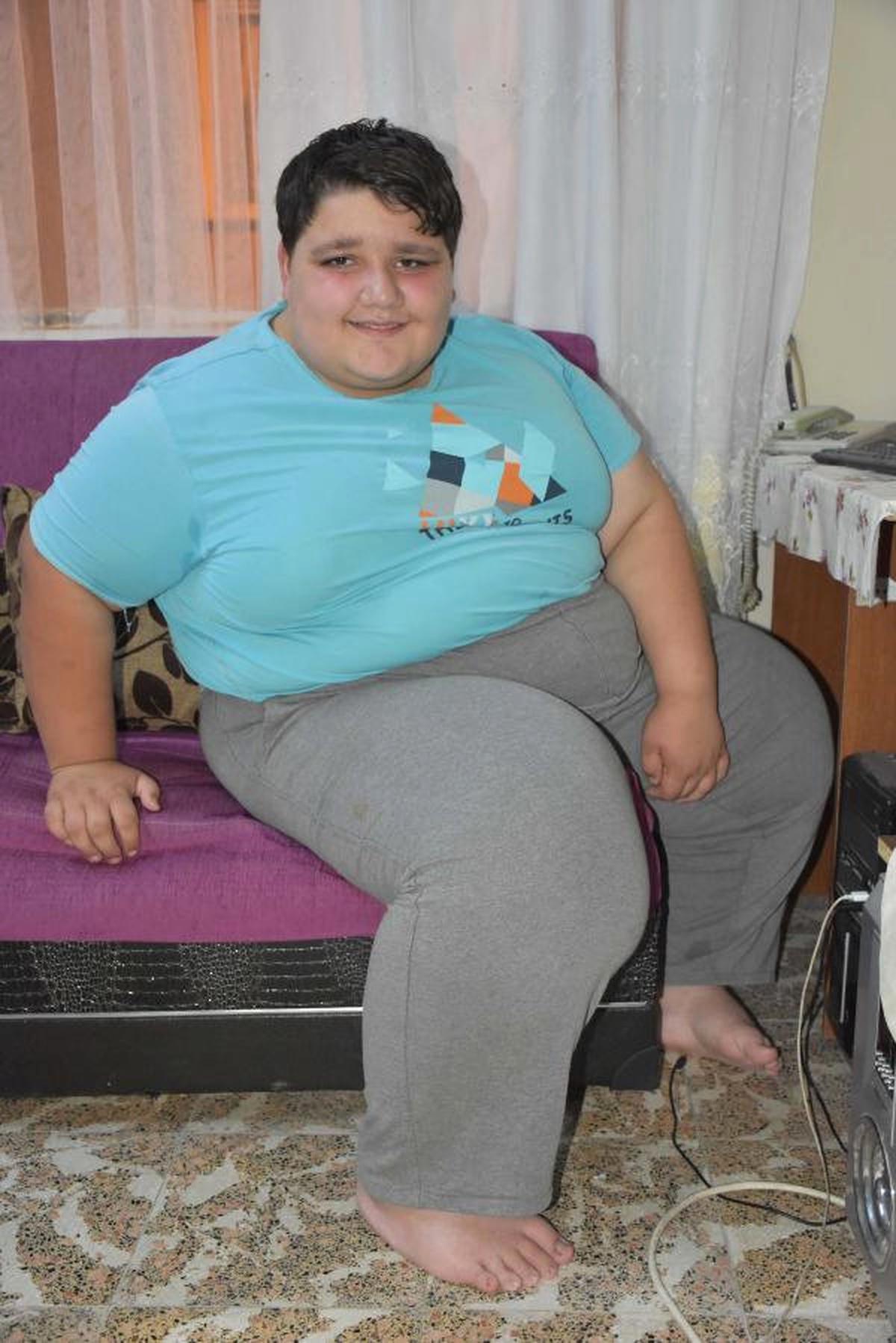 Obezite Hastalığı Olan Çocuk Tedavi İçin Yardım Bekliyor