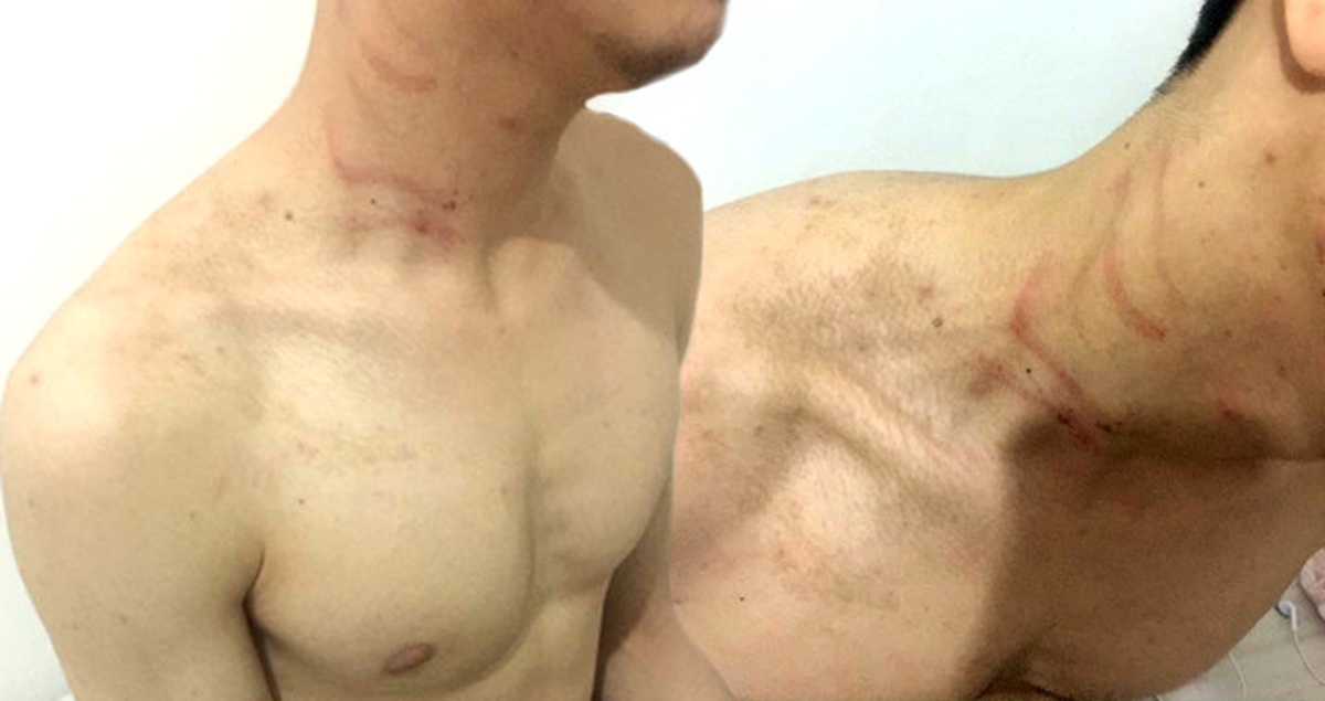 Hırsızlıkla Suçladıkları Genci Önce Darp Ettiler, Sonra Tokalaşmak İstediler