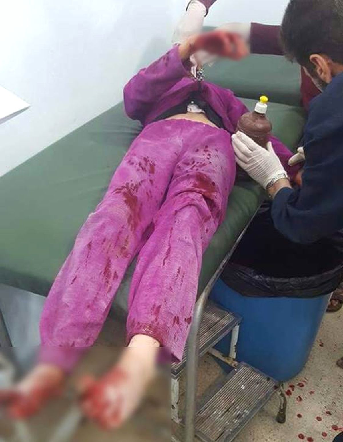 Pkk/pyd Suriye\'de Sivilleri Hedef Aldı: 4 Ölü, 20 Yaralı
