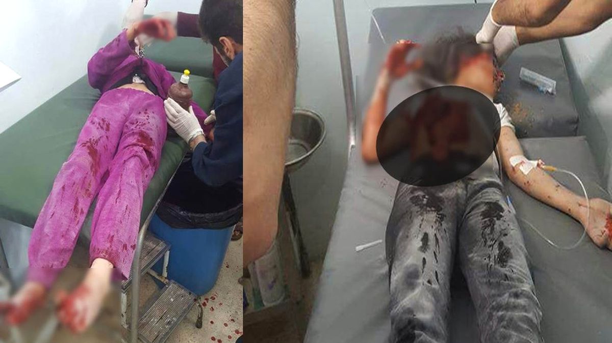 Dha Ankara - Tsk: PKK\'dan  Azez ve Mare\'ye Topçu Saldırısı: 2 Ölü 7 Yaralı
