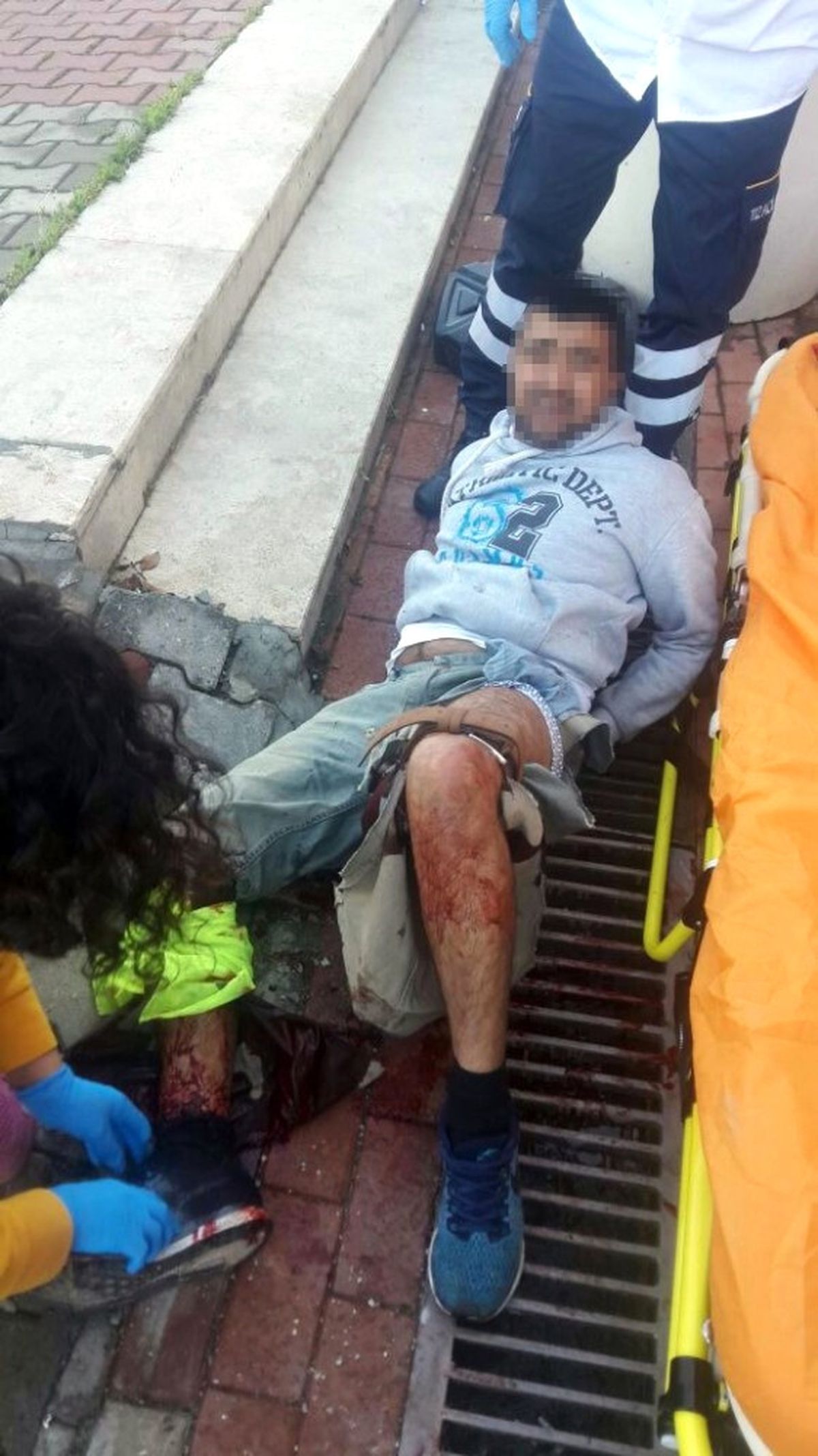 Polise Bıçakla Saldıran Kablo Hırsızı Vurularak Yakalandı