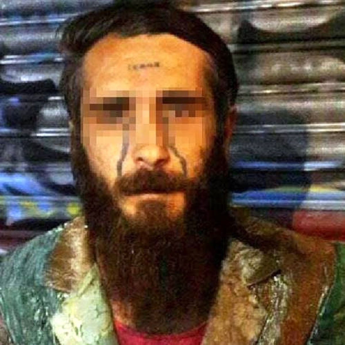 Alnında "Enayi" Yazan Şahıs Yakalandı
