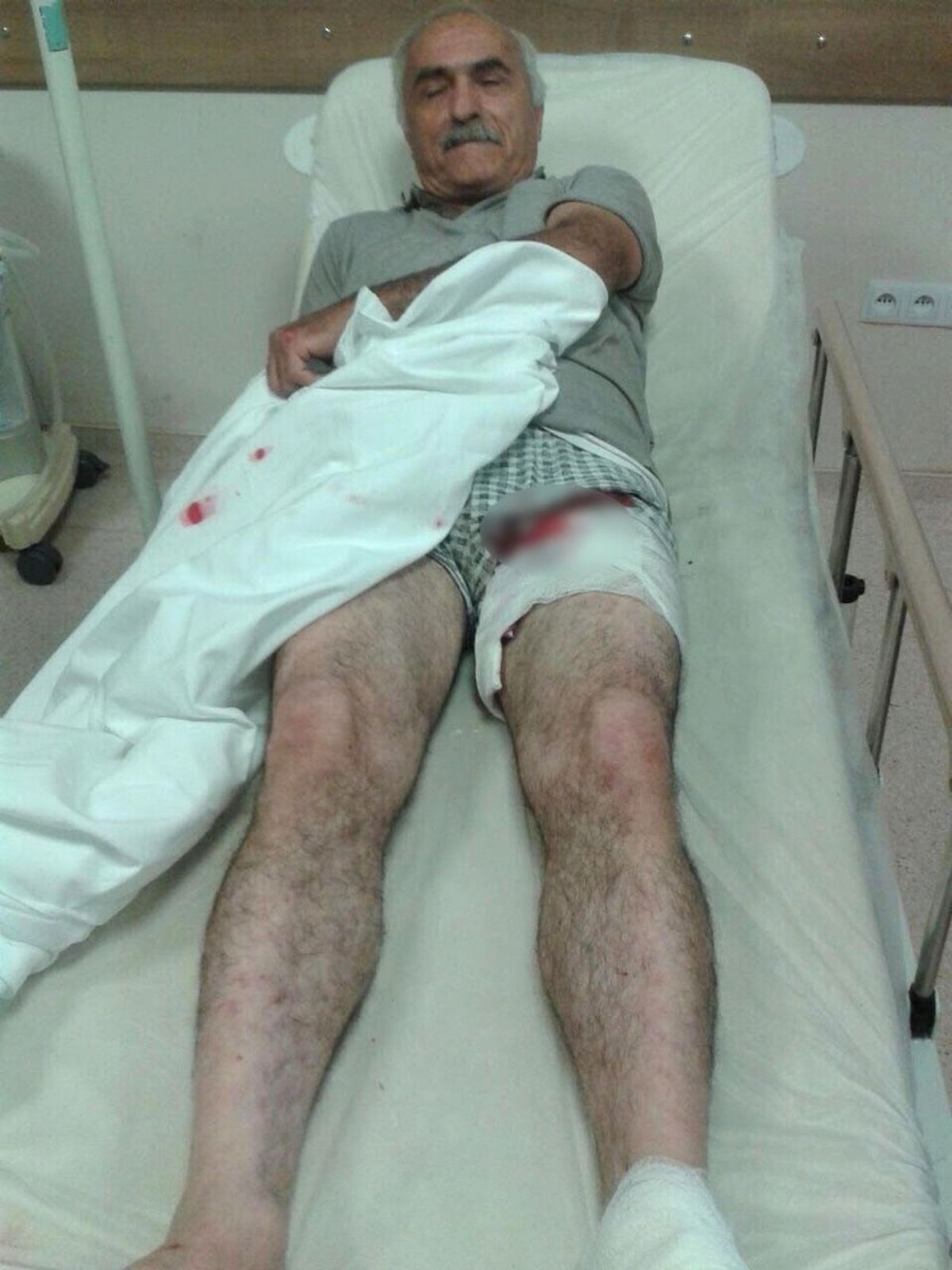 Ayının Saldırısına Uğrayan İnşaat Ustası Yaralandı