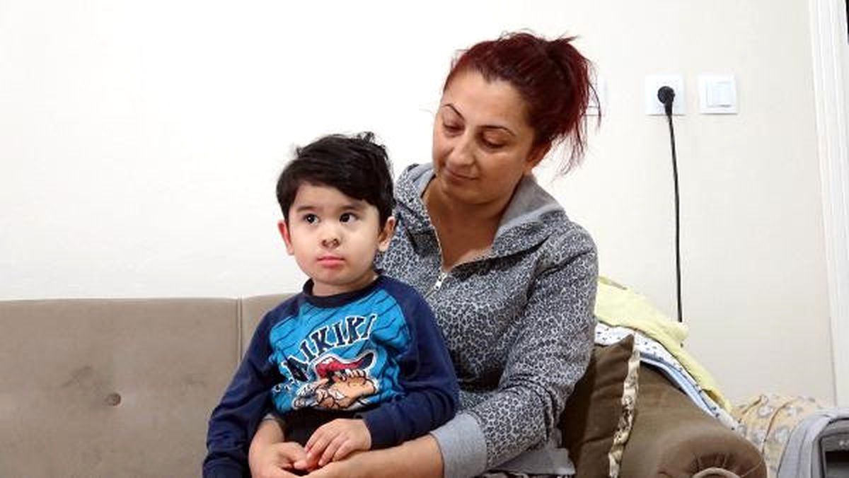 Dudak ve Burnu Eksik Doğan 2 Yaşındaki Ege Umut\'a 5\'inci Ameliyat