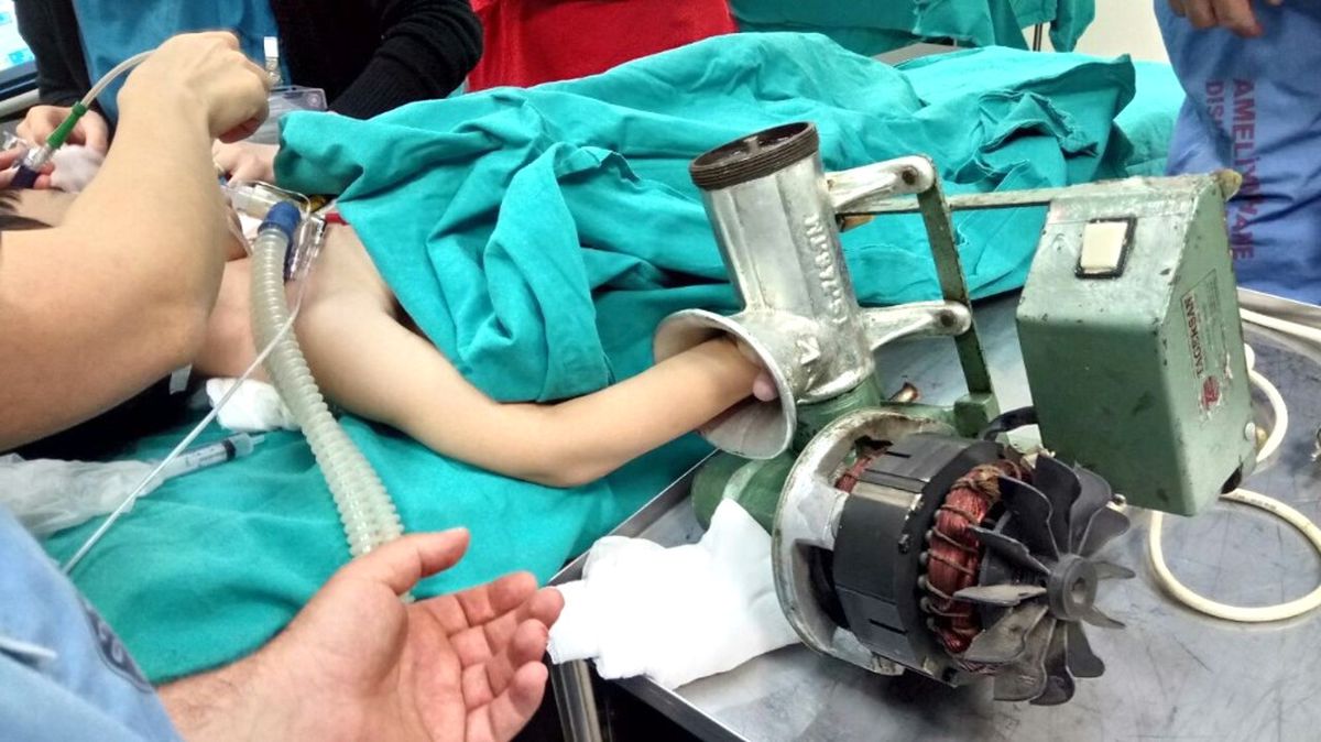 Elini Kaptırdığı Kıyma Makinesiyle Hastaneye Kaldırıldı