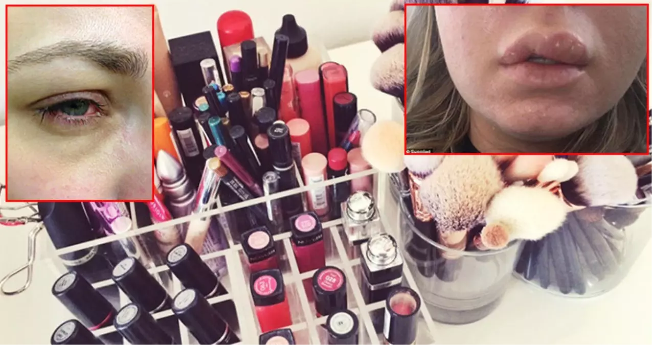 Taklit Ruj Kullanan Kadının Dudağı Yandı, Göz Farı da Az Kalsın Kör Ediyordu!