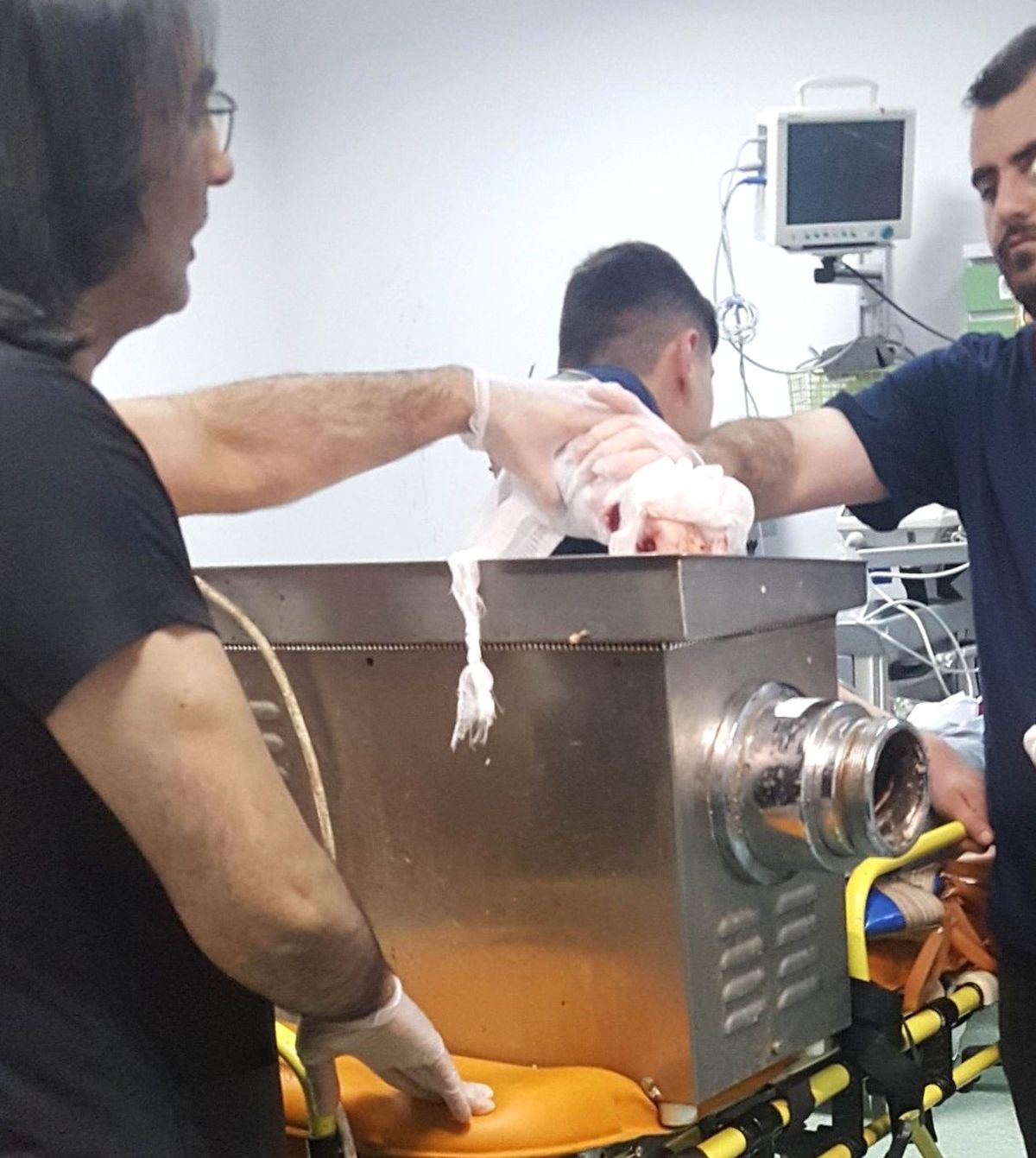 Elini Kaptırdığı Kıyma Makinesiyle Hastaneye Kaldırıldı