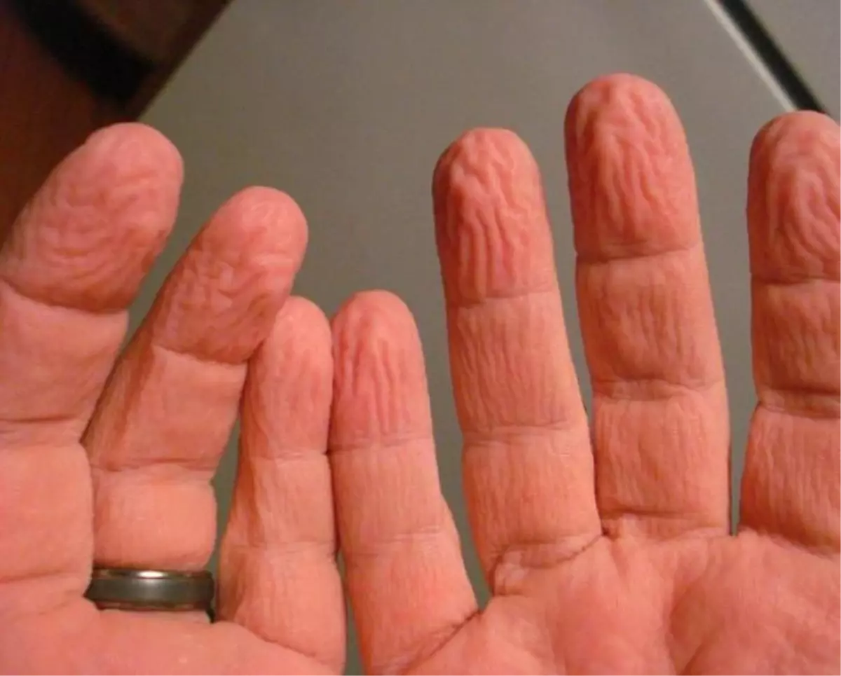 Suda Kalan Parmakların Buruşma Nedeni Ortaya Çıktı!