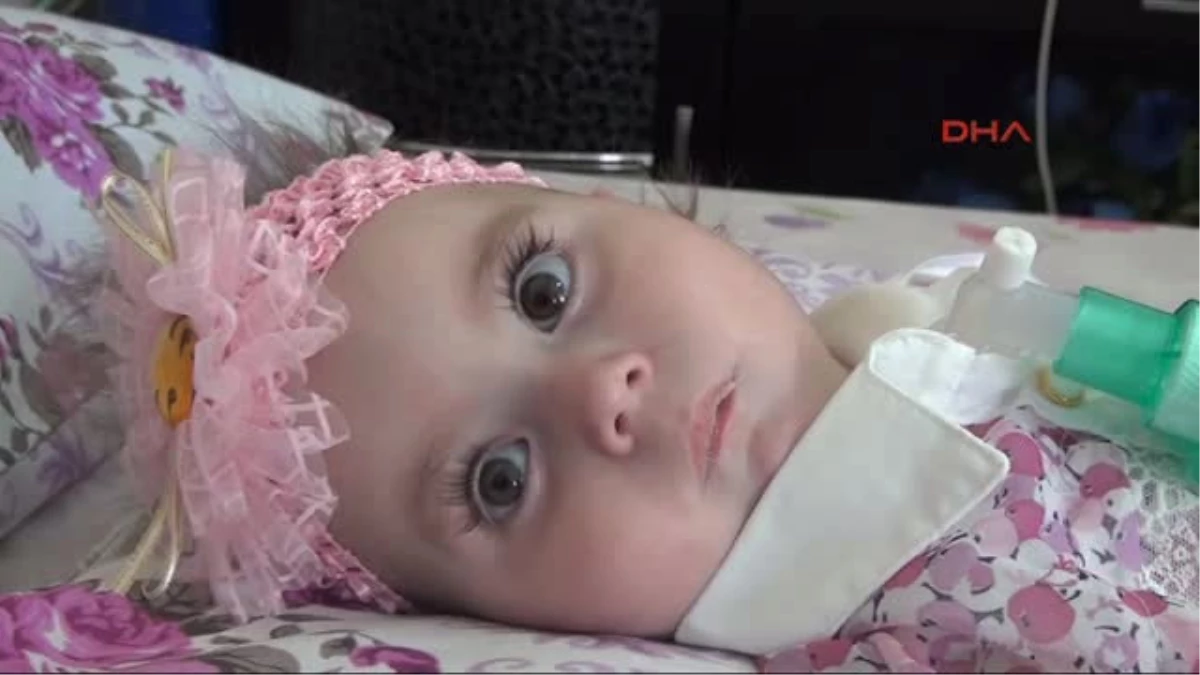 Manisa - Sma Hastası Zeynep Bebek, Yaşama Tutunamadı