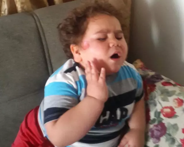 Minik Fenomen “Çitos Efe“ Kaza Geçirdi Son Dakika