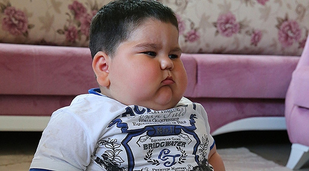 1,5 Yaşında 36 Kiloya Ulaşan Yağız Bebek Tedavi İçin İlaç Bekliyor