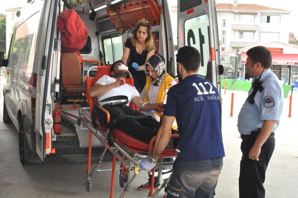 Motosikletini Çalan Hırsızın Burnunu Kırdı