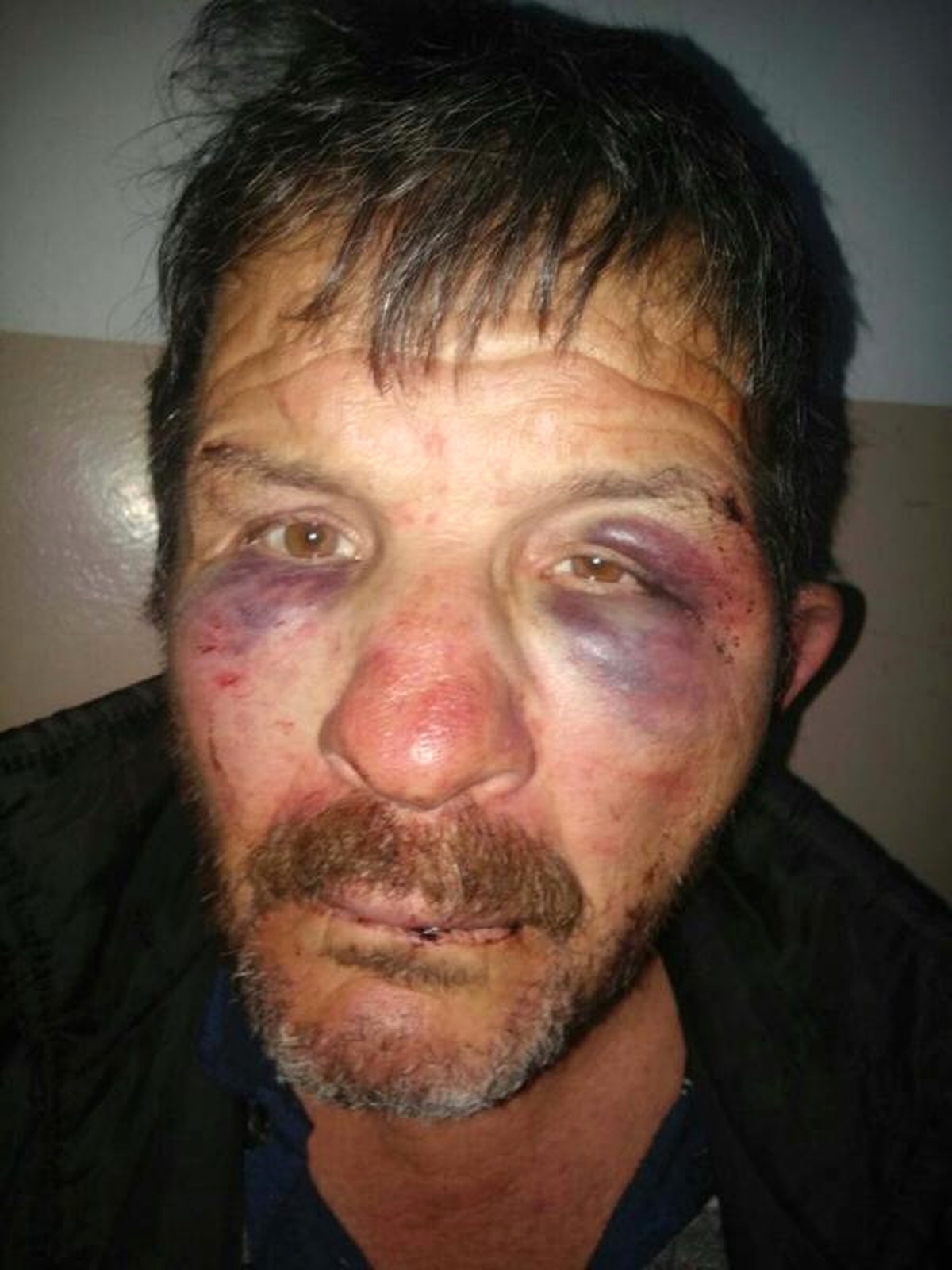 12 Yaşındaki Çocuğa Tecavüz Şüphelisine Dayak