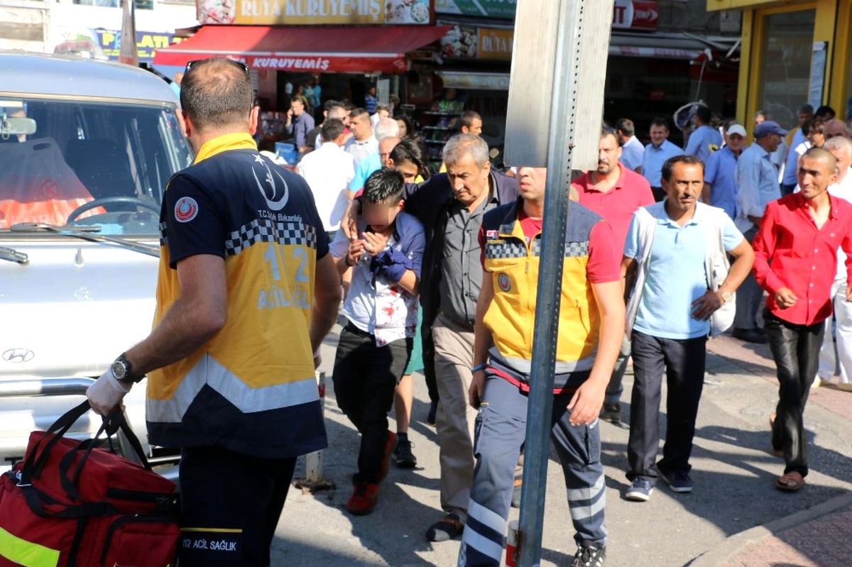 Kız Arkadaşı ile Tartışan Genç Kendisini Doğradı