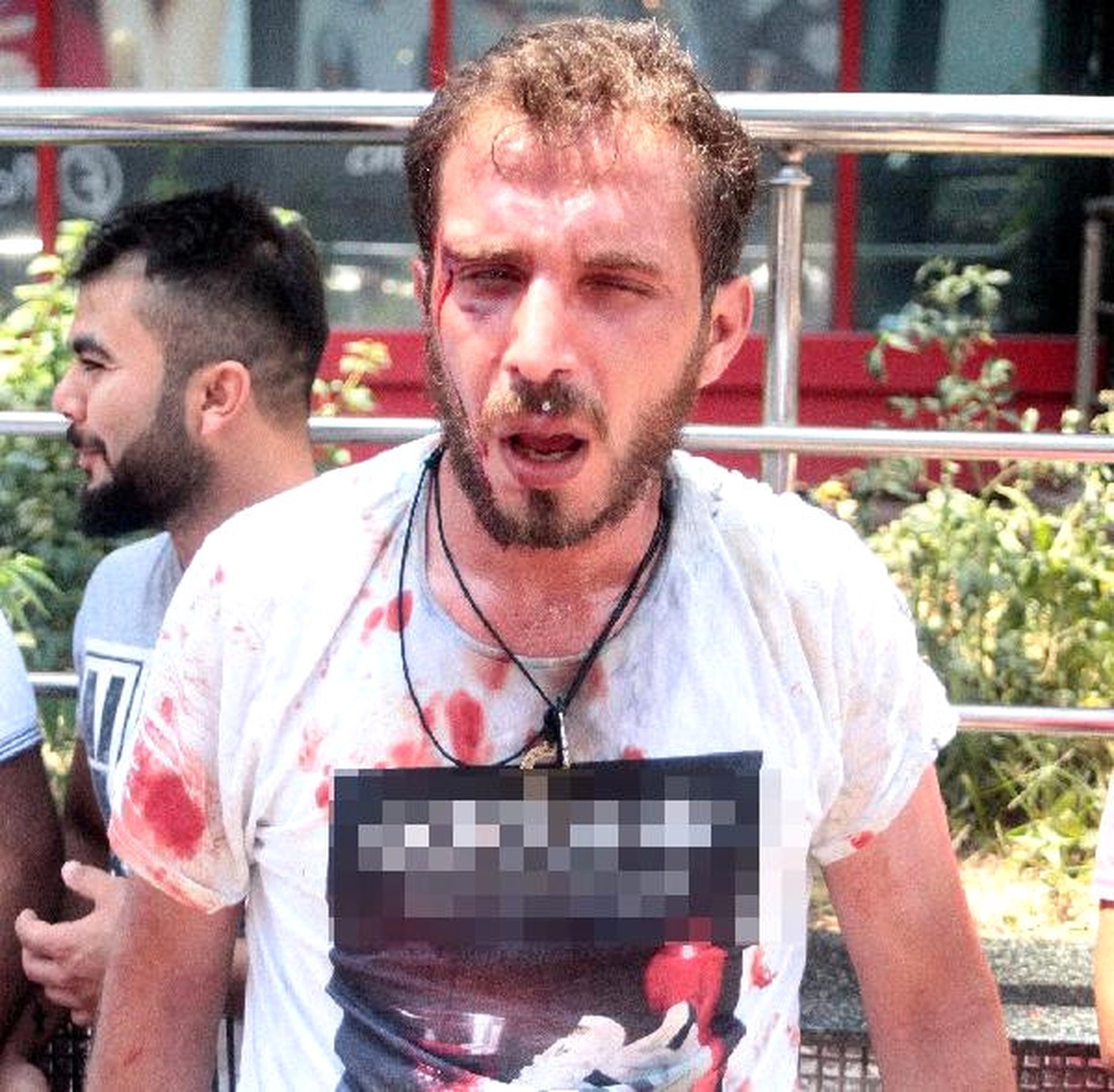 Seyyar Satıcılarla Zabıtalar Kavga Etti: 2 Yaralı