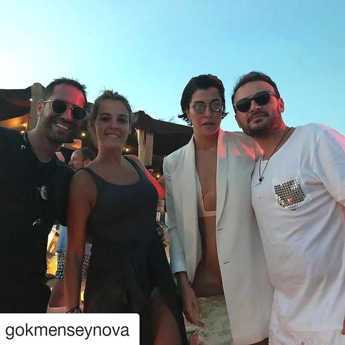 Photoshop\'u Abartan Deniz Akkaya, Göğsü ve Eteğini Yok Etti