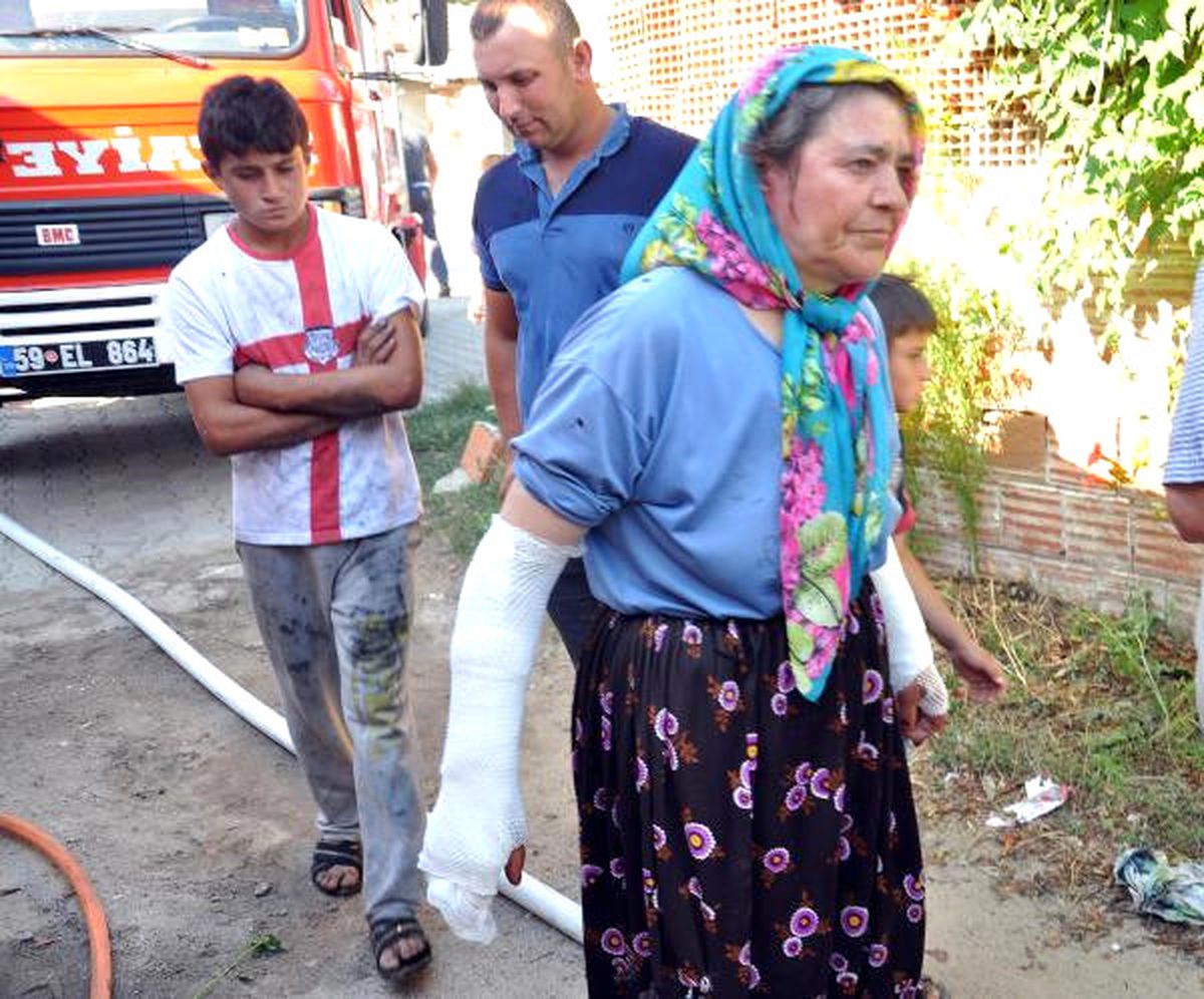 Evde Çıkan Yangında Karı-koca Yaralandı