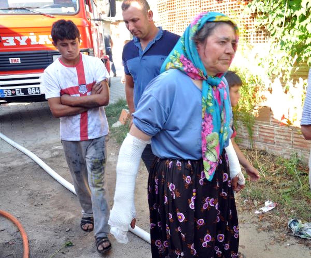 Evde Çıkan Yangını Söndürmek İsteyen Karı-koca Yaralandı