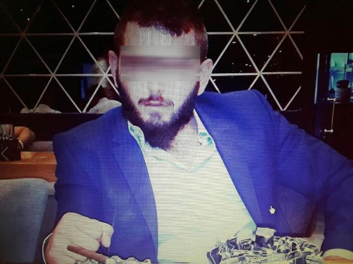 Sokakta Yürürken Maganda Kurşunu ile Yaralandı