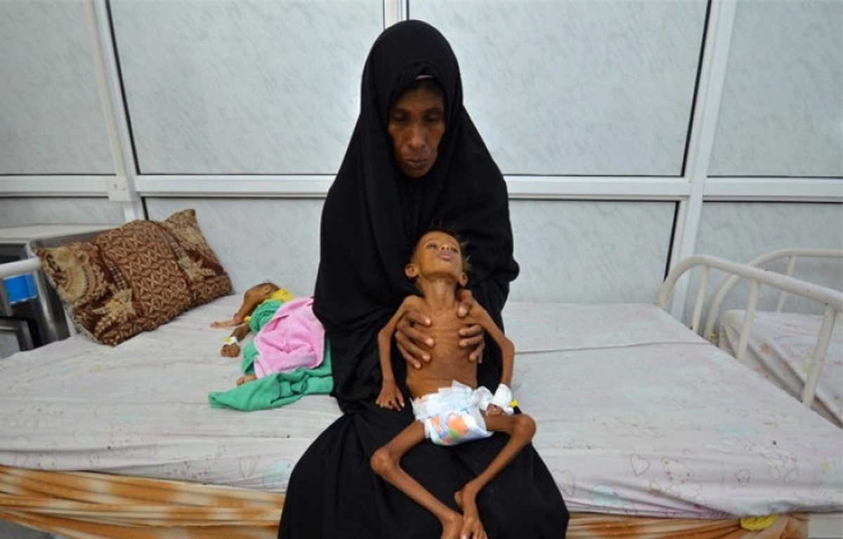 Yemen\'de 7 Milyon Kişi Açlık Tehlikesiyle Karşı Karşıya