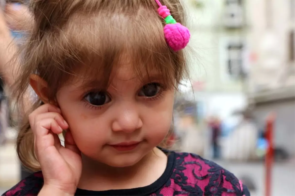 Sol Gözünü Tamamen Kaybetme Riski Olan Simay Bebek Yardım Eli Bekliyor