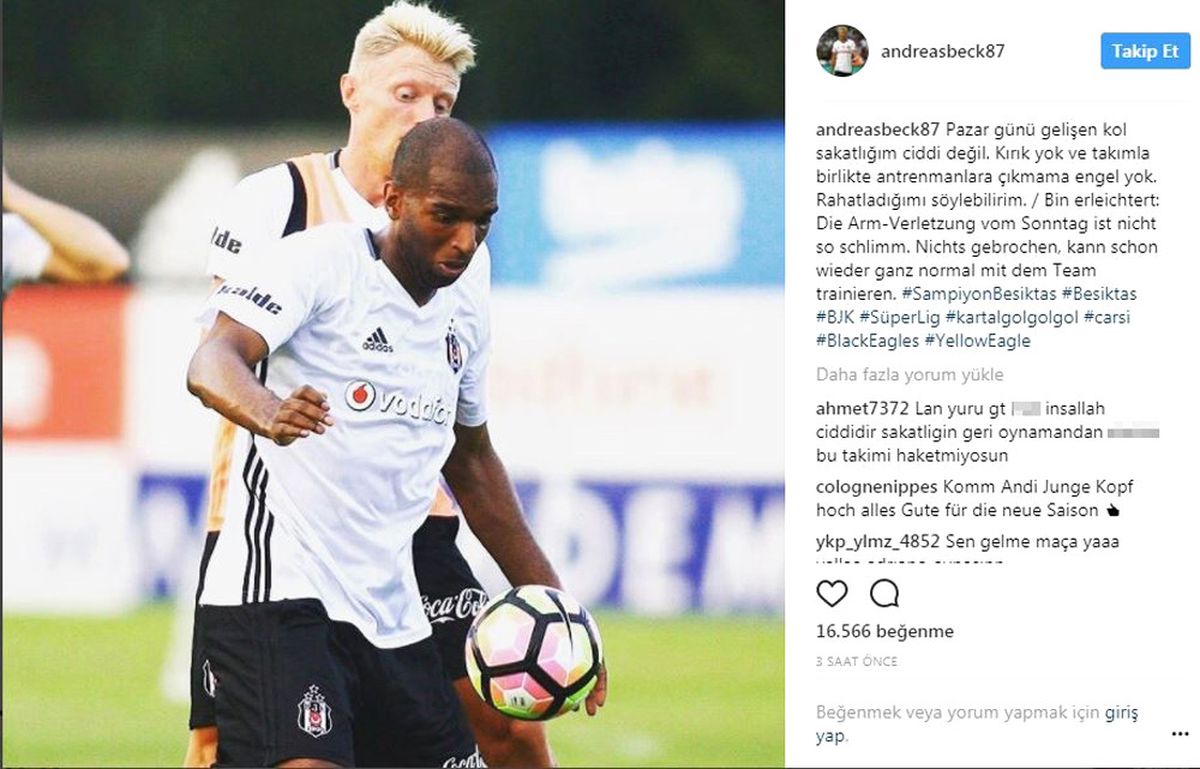 Beck: Sakatlığım Ciddi Değil