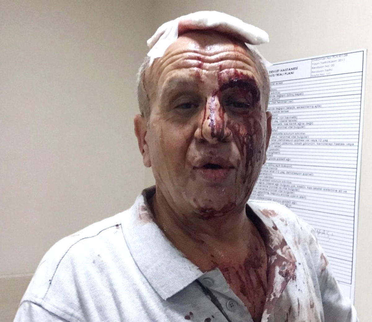 Ağabey-kardeş Arasındaki Arsa Kavgası Kanlı Bitti: 5 Yaralı