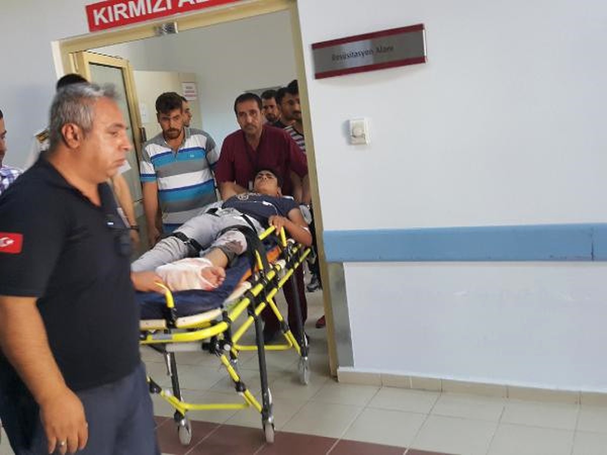 Motosiklet Kazasında Ayağı Koptu