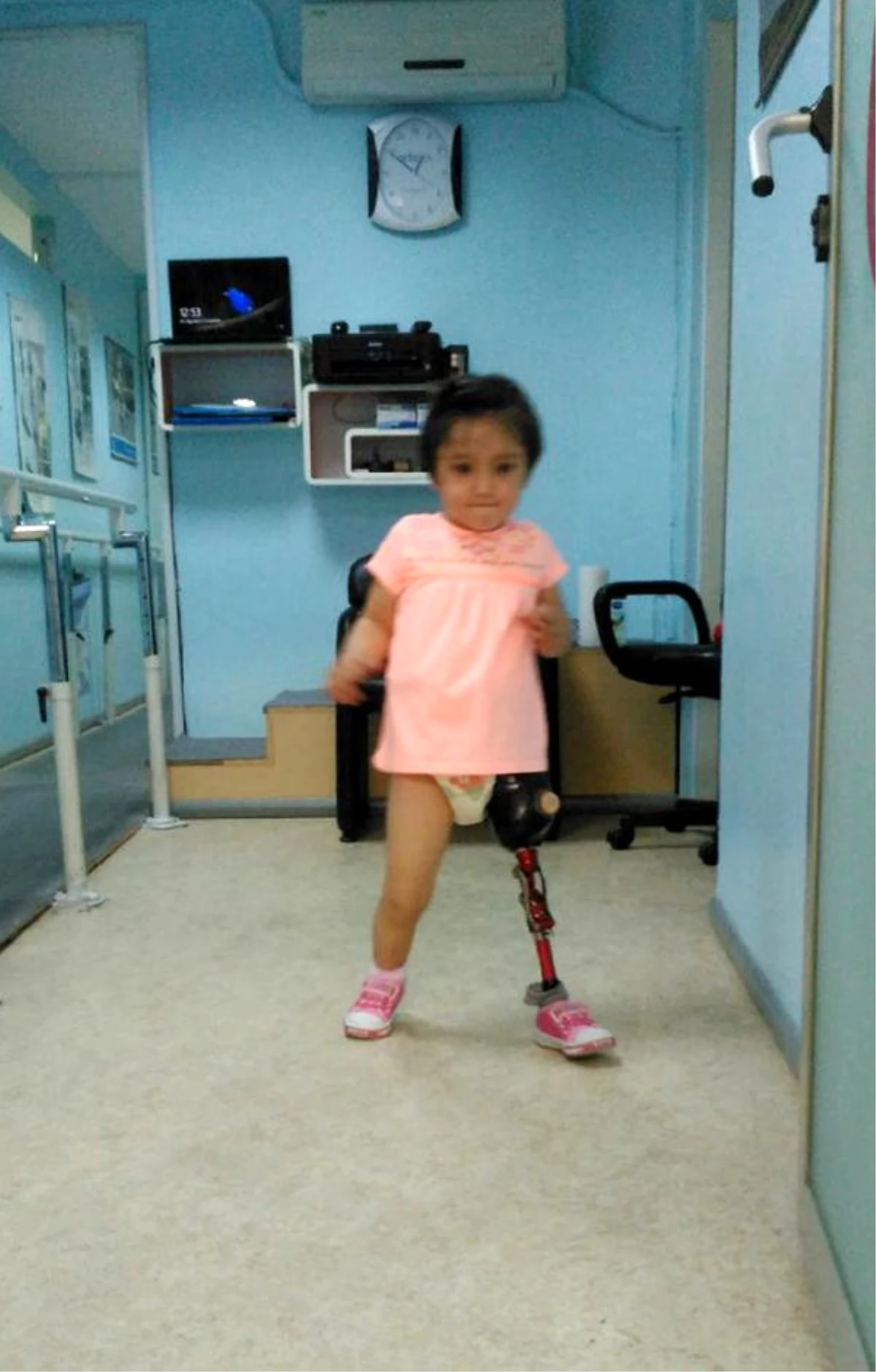 Özge Bebek Yeni Protez Bacağıyla Daha Az Düşüyor
