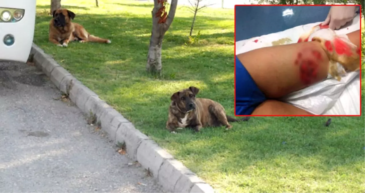 Eskişehir\'de 5 Köpeğin Saldırısına Uğrayan Çocuk, Ölümden Döndü