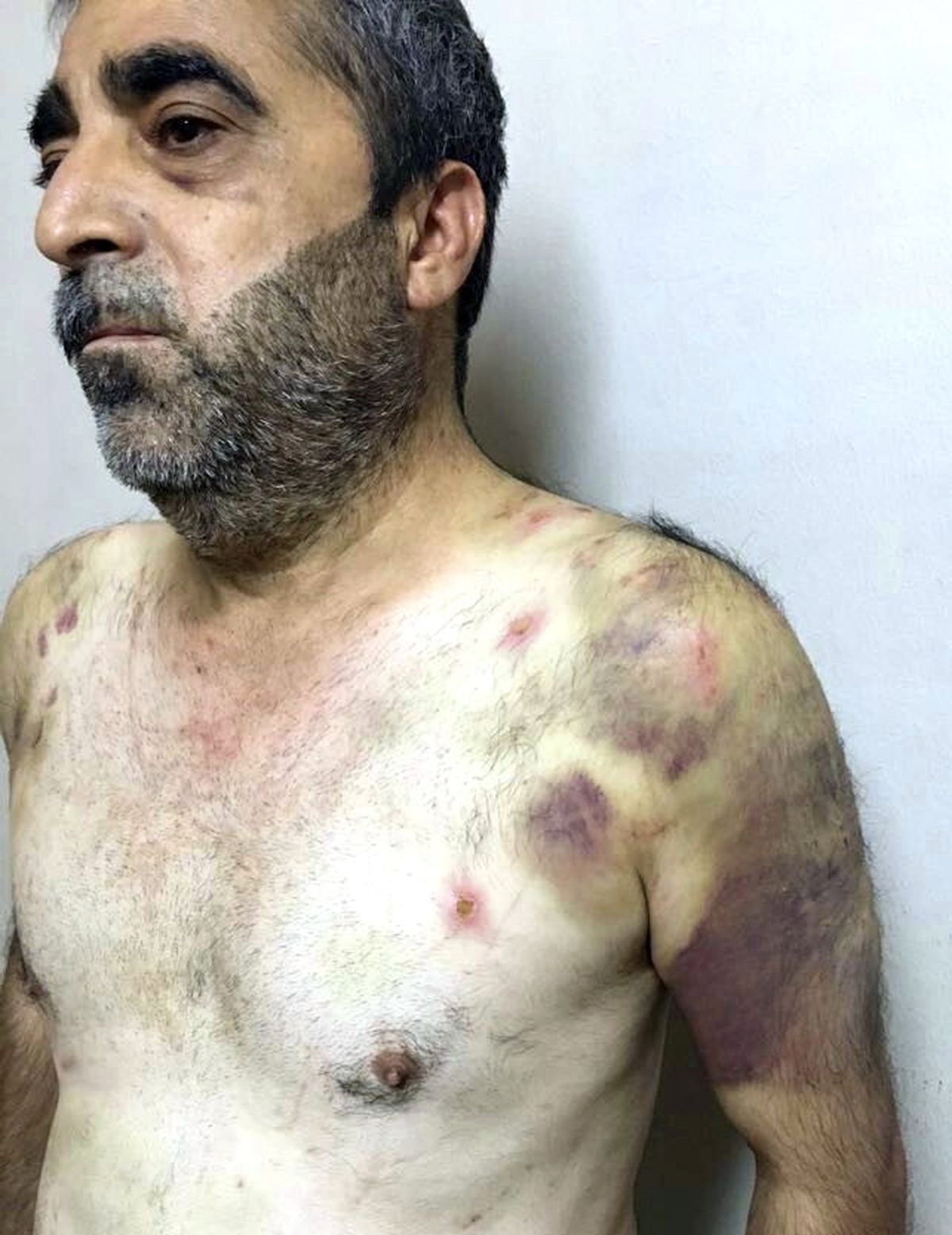 İstanbul\'da Fidye Operasyonu