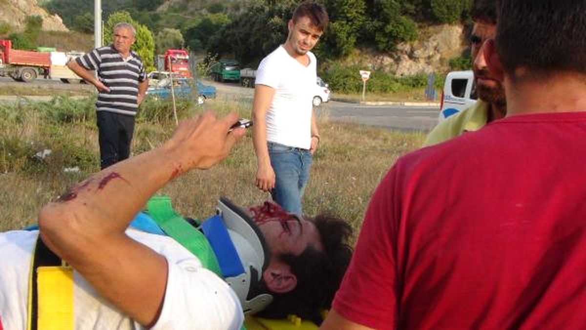 Takla Atan Motosikletteki 2 Kardeş Yaralandı