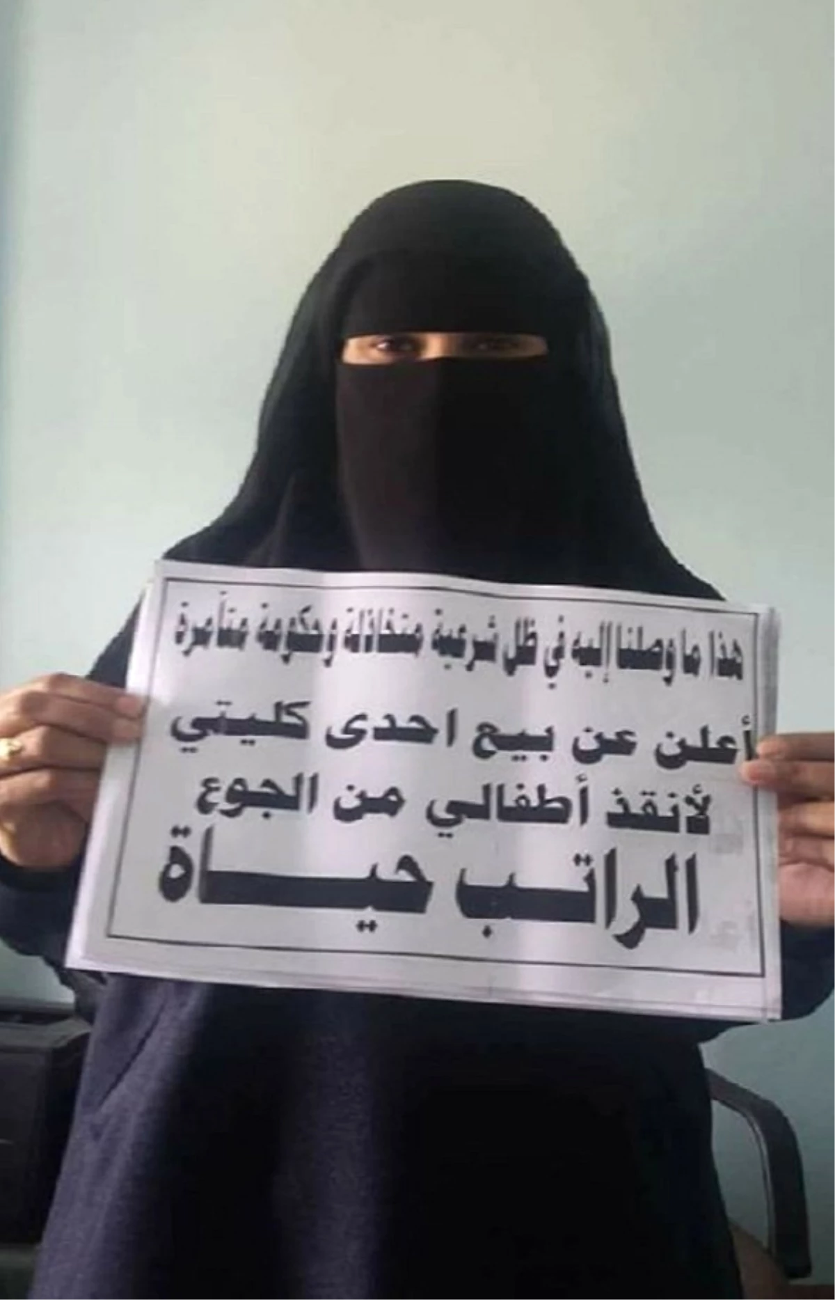Yemenli Kadın Çocukları İçin Böbreğini Satışa Çıkarttı