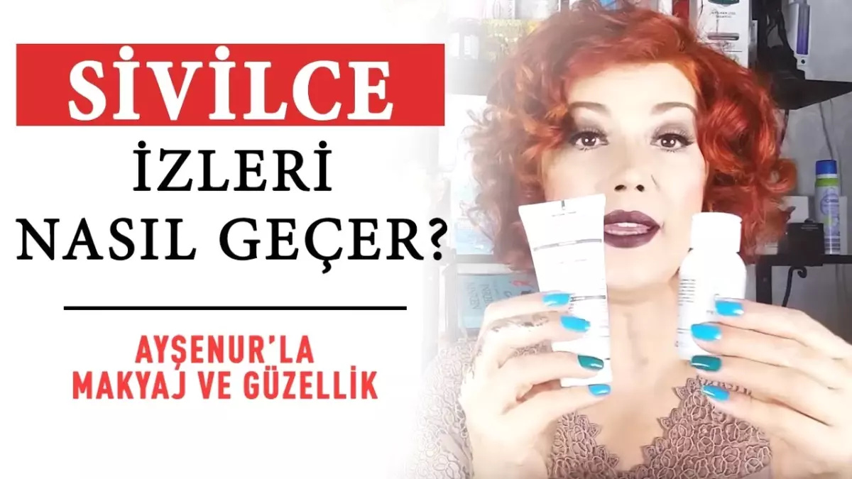 Sivilce İzleri Nasıl Geçer?