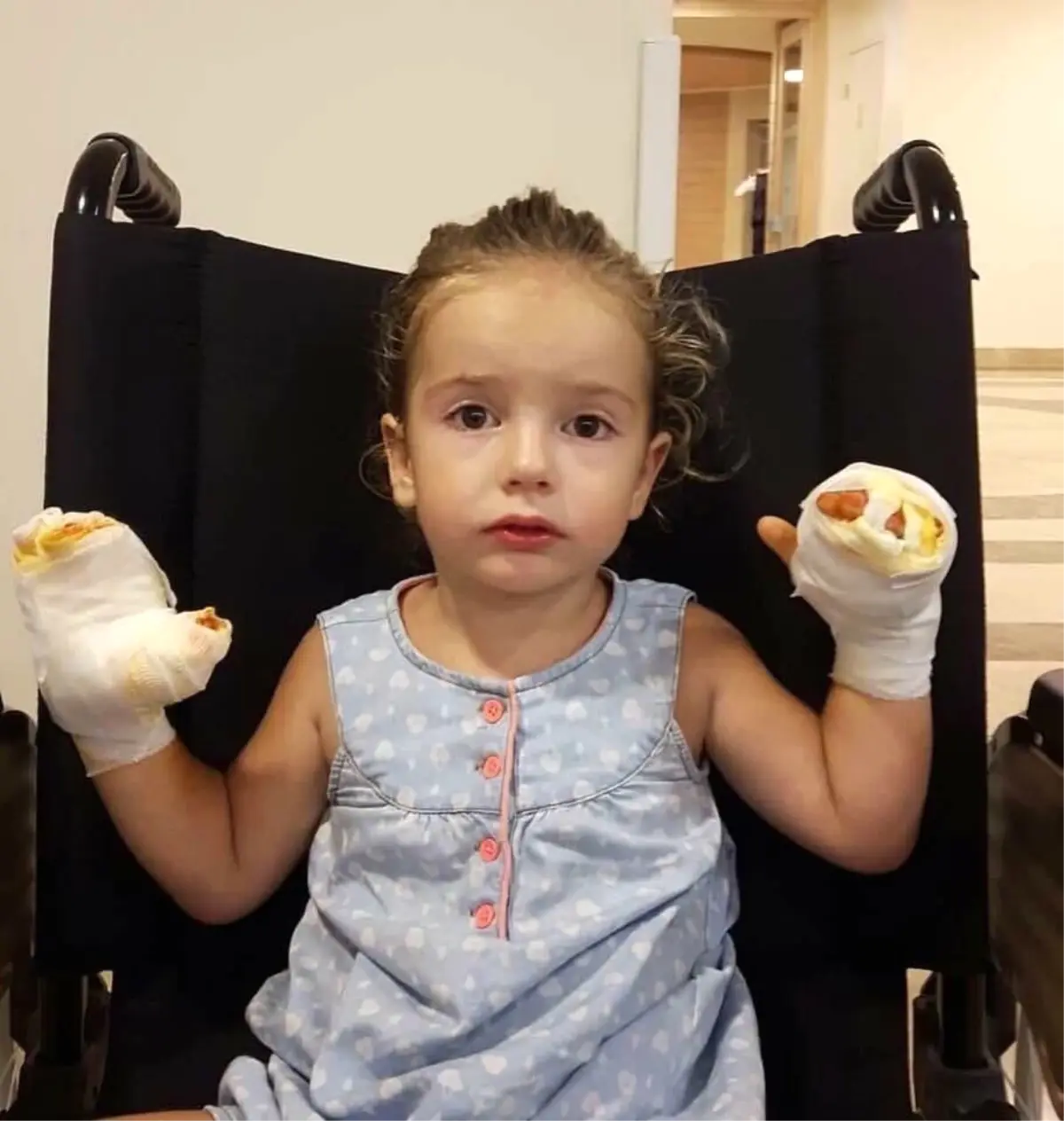 İçinde Yanıcı Gaz Bulunan Uçan Balon Küçük Kızı Yaktı