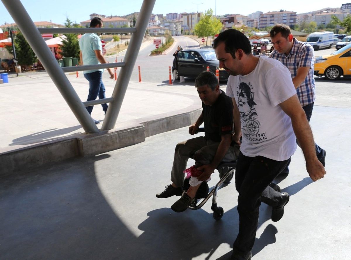Nevşehir\'de Acemi Kasaplar Hastaneye Koştu