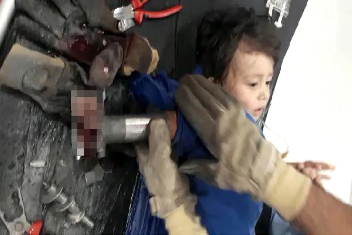 2 Yaşındaki Mustafa, Elini Kıyma Makinesine Kaptırdı
