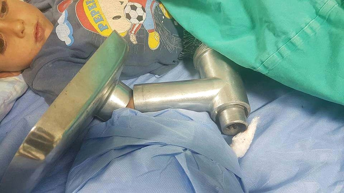 Küçük Çocuk Elini Kıyma Makinesine Kaptırdı