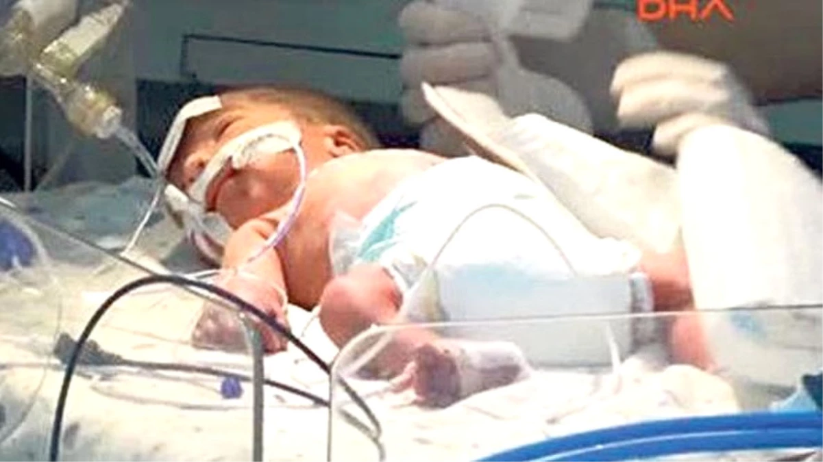 Anne Karnında Babasının Vahşetine Şahit Olan Mustafa Bebeğin Beyin Hücreleri Öldü